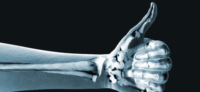 Skelett av underarm och hand