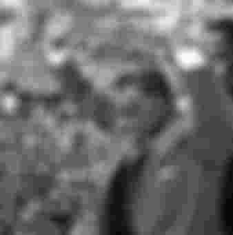 Abdel Nasser at a rally after the rupture of relations with Syria.