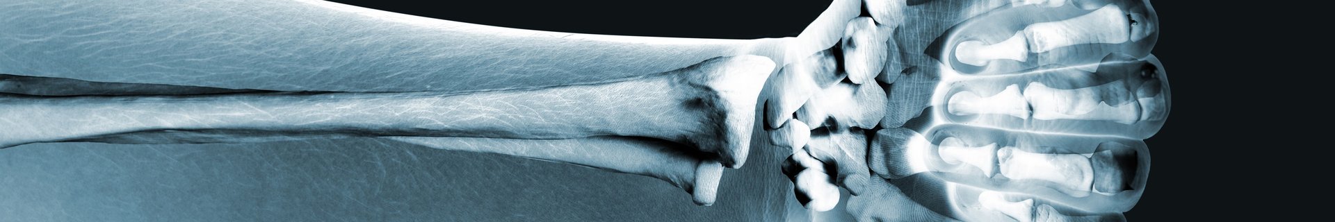 Skelett av underarm och hand