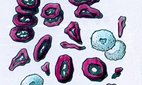 Poster depicting the degeneration of blood cells.