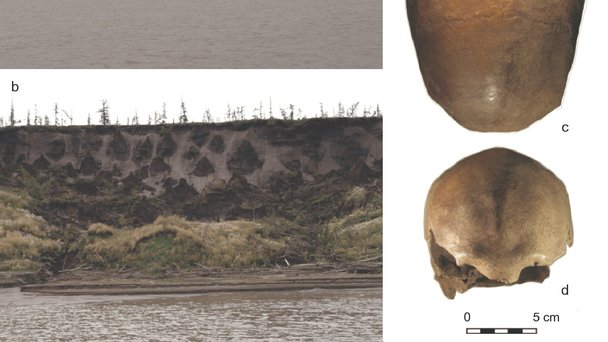 Forskarna hittade spår av hepatit i en skalle hittad vid Kolymafloden i östra Sibirien. Foto: Vladimir Pitulko