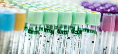 Provrör i olika färger